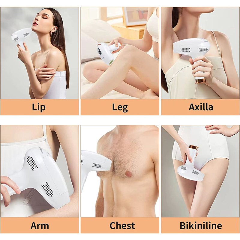 The principle and effect of IPL hair removal