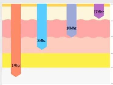 1MHz, 3MHz, 10MHz, and 17MHz frequency ultrasound